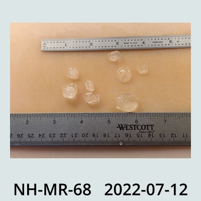 Hail Obs Photo