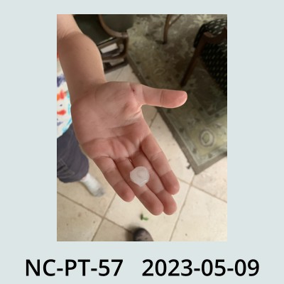 Hail Obs Photo