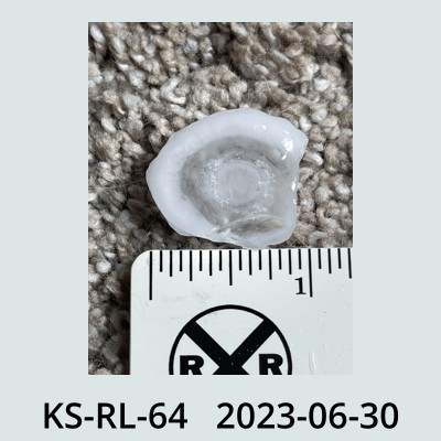 Hail Obs Photo
