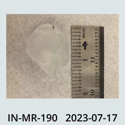 Hail Obs Photo