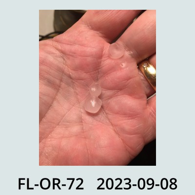 Hail Obs Photo