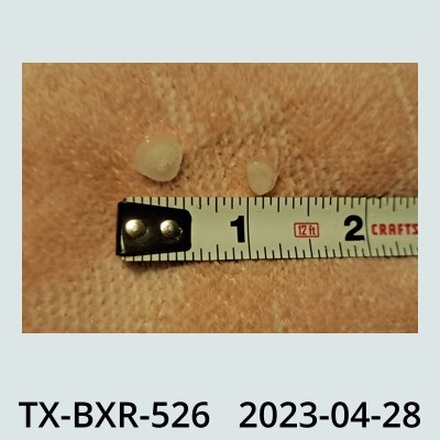 Hail Obs Photo