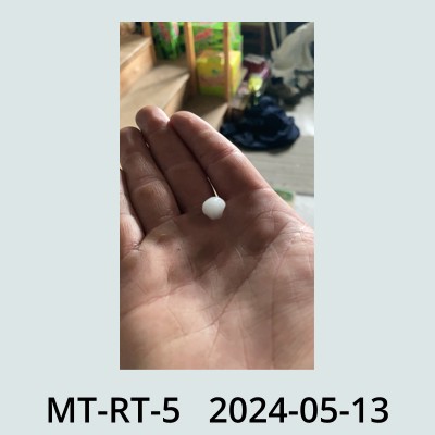 Hail Obs Photo