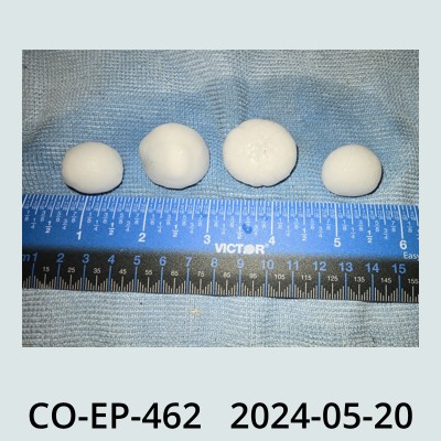 Hail Obs Photo