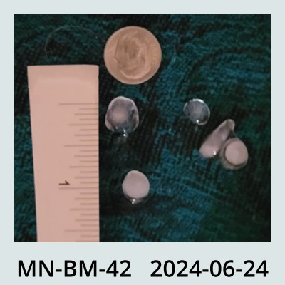 Hail Obs Photo