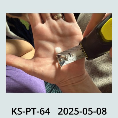 Hail Obs Photo