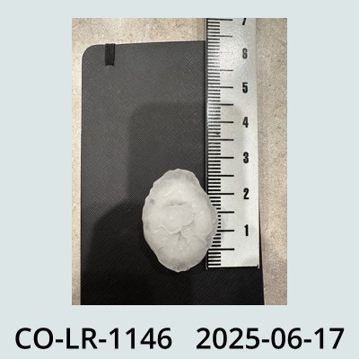 Hail Obs Photo