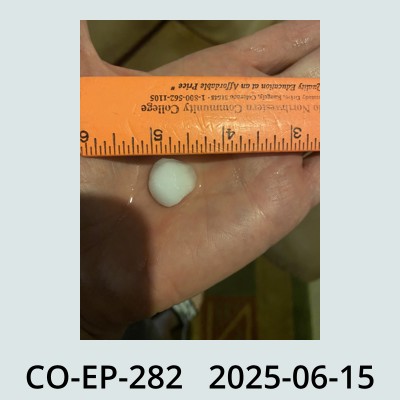 Hail Obs Photo