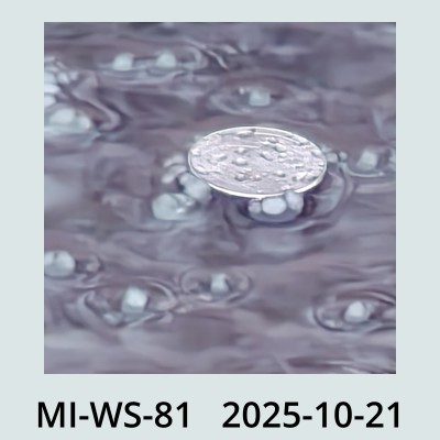 Hail Obs Photo