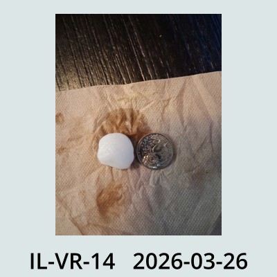 Hail Obs Photo