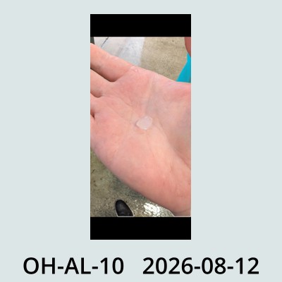 Hail Obs Photo