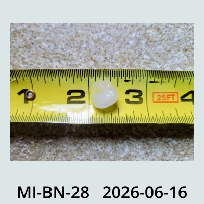 Hail Obs Photo