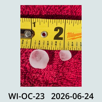 Hail Obs Photo