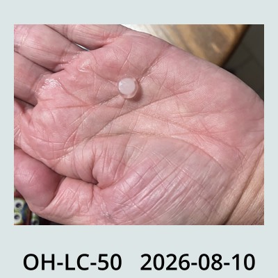 Hail Obs Photo