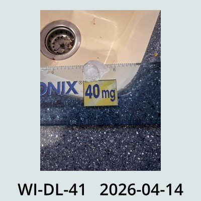 Hail Obs Photo