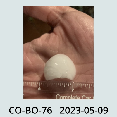 Hail Obs Photo